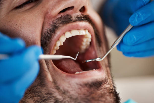 Best Emergency Dentist for Knocked-Out Tooth in Meadow Vista, CA